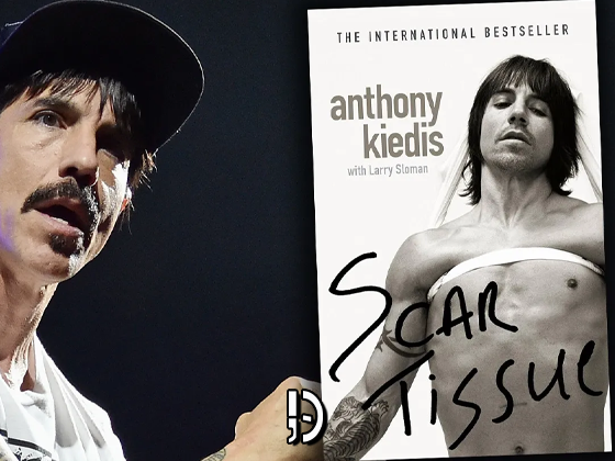 Universal adquire direitos de “Scar Tissue”, de Anthony Kiedis do RHCP